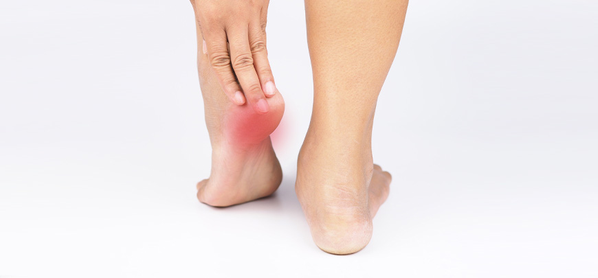 patient receiving plantar fasciitis in Oklahoma City