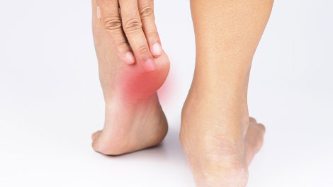 patient requiring plantar fasciitis treatment in Oklahoma City