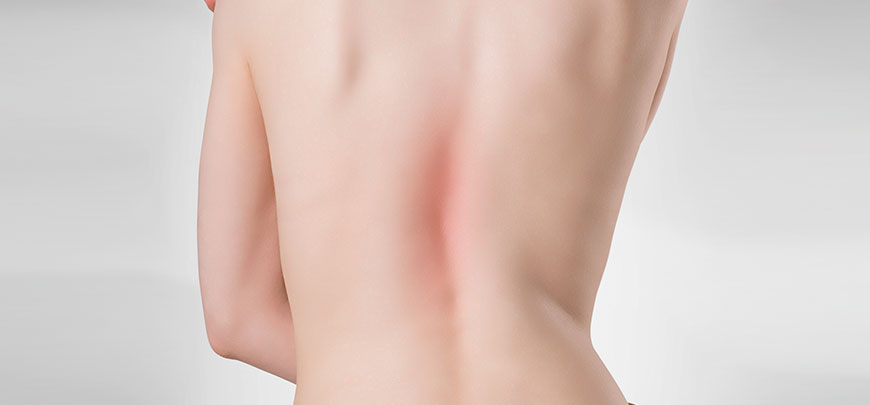 patient needing scoliosis treatment in Oklahoma City
