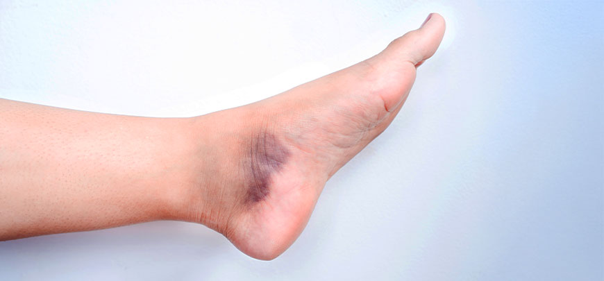 patient needing sprain treatment in Oklahoma City