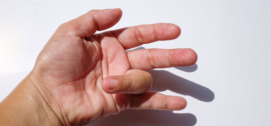 patient needing trigger finger treatment in Oklahoma City